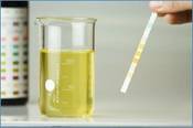 Test auf erhöhte Eiweißausscheidung im Urin