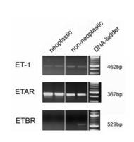 ET PCR-Bilder