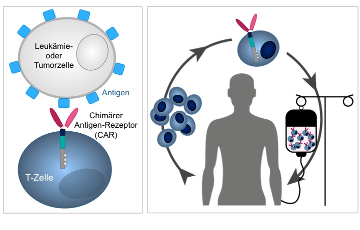 Während die Antigenerkennung über Peptid/MHC-spezifische T-Zellen auf effiziente Antigenpräsentation angewiesen ist, erkennen T-Zellen über CARs Oberflächenantigene auf der Tumorzelle.